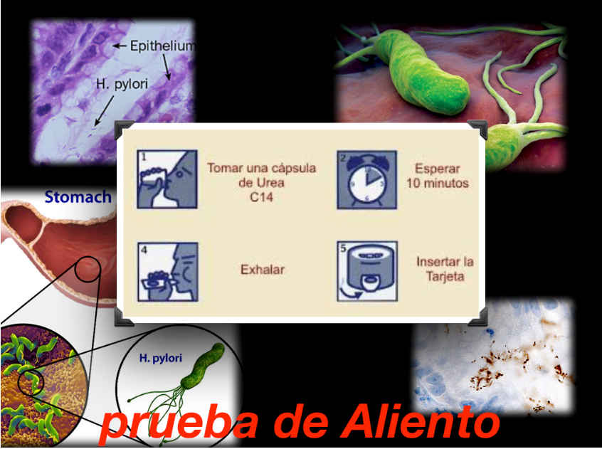 Prueba de aliento GOODMAN